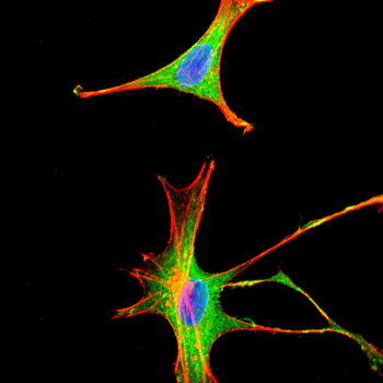 CXCL2 Antibody