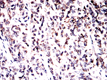 CXCL2 Antibody