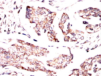 CXCL2 Antibody