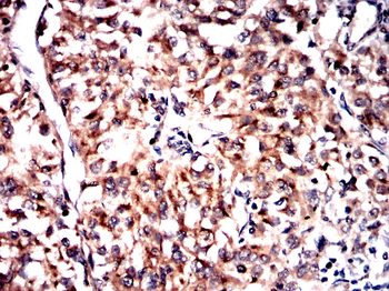 CXCL2 Antibody