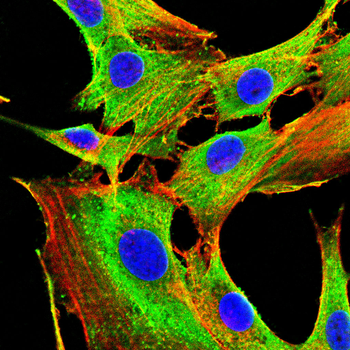 CXCL2 Antibody