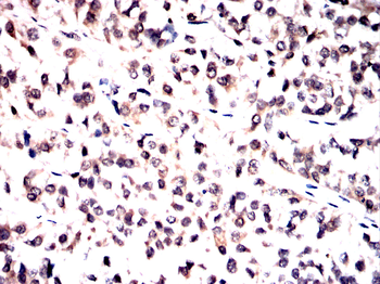 NPM1 Antibody