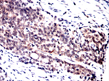 NPM1 Antibody