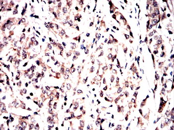 NPM1 Antibody