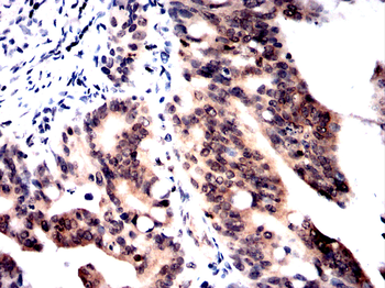NPM1 Antibody