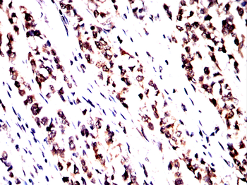 EIF2AK4 Antibody