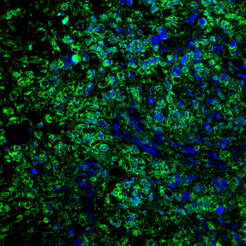 EIF2AK4 Antibody