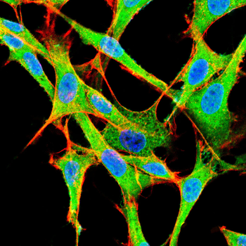 SCD Antibody