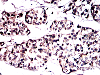 SCD Antibody