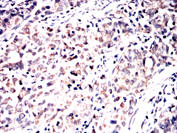 SCD Antibody
