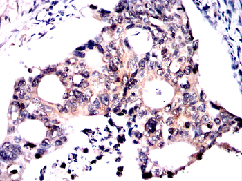 SCD Antibody