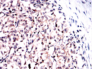 SCD Antibody