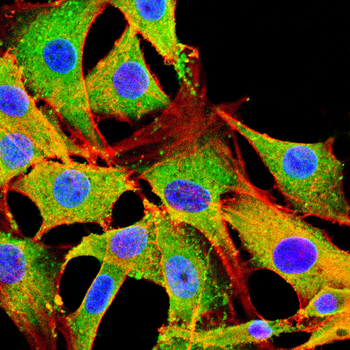 SCD Antibody