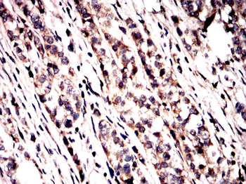 SCD Antibody