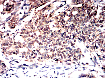SCD Antibody