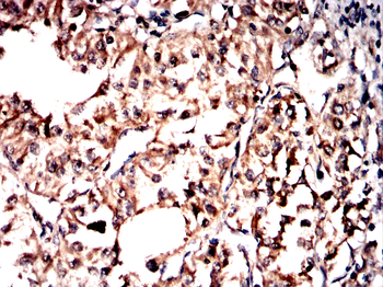 SCD Antibody