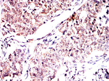 HMGCS1 Antibody