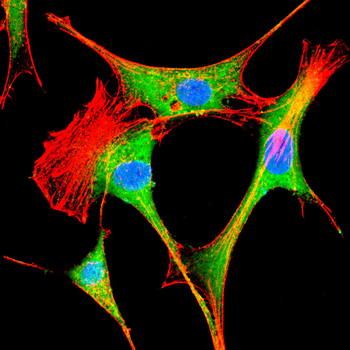ABCD3 Antibody