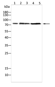 ABCD3 Antibody