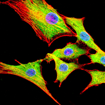 ABCD3 Antibody