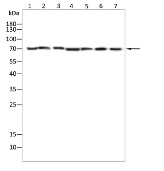 ABCD3 Antibody
