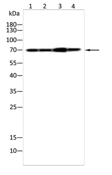 ABCD3 Antibody