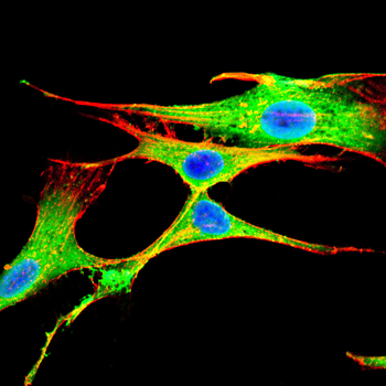 KPNB1 Antibody