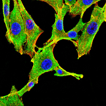 KPNB1 Antibody