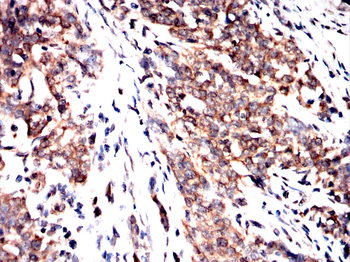 KPNB1 Antibody