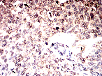 KPNB1 Antibody