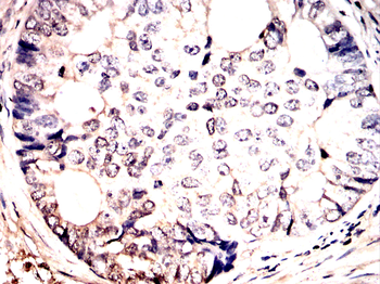 KPNB1 Antibody