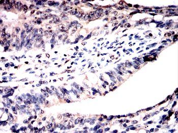 KPNB1 Antibody