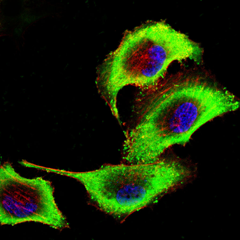LCP2 Antibody