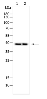 CTSB Antibody
