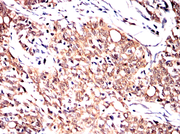 SDCBP Antibody