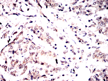 SDCBP Antibody