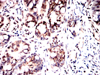 SP1 Antibody