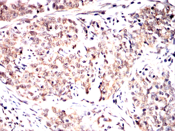 HDAC7 Antibody