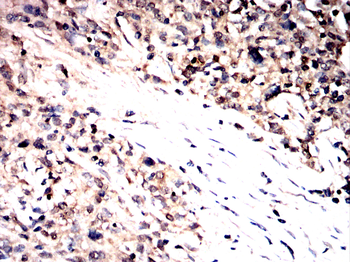 HDAC7 Antibody