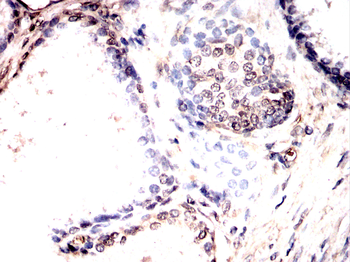 HDAC7 Antibody