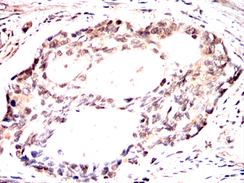 HDAC7 Antibody
