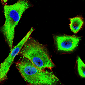 HDAC7 Antibody