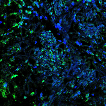 PTBP1 Antibody