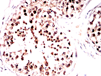LIPE Antibody