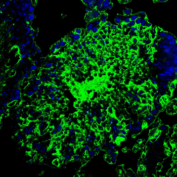 LIPE Antibody