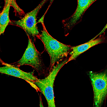 FADS1 Antibody