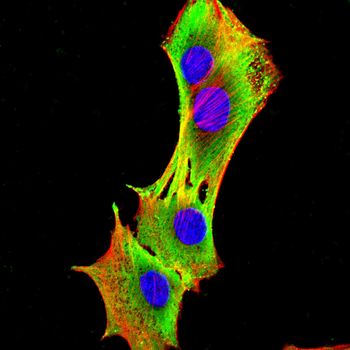 FADS1 Antibody