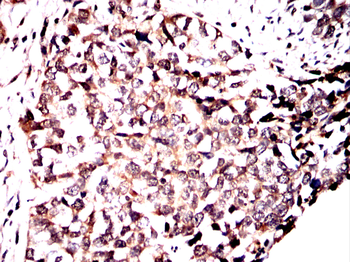 FADS1 Antibody