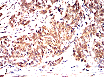 FADS1 Antibody