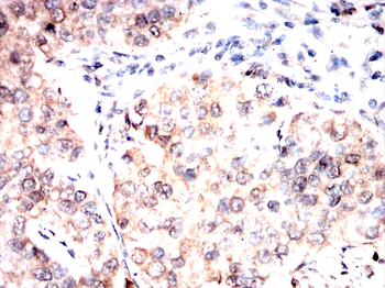FADS1 Antibody